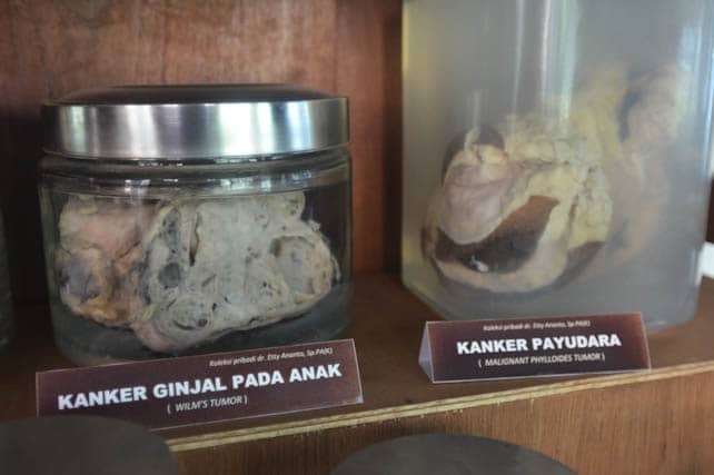 museum kanker Indonesia